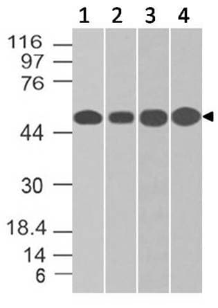 ENO2 / NSE Antibody