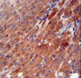 CES2 / Esterase Antibody (aa340-369)