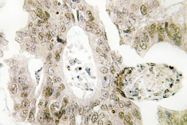 MUTYH / MYH Antibody (Tyr176)