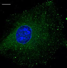 RAB5B Antibody (C-Terminus)