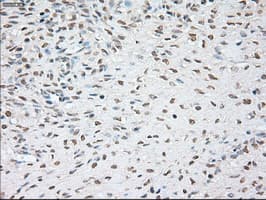 NOG / Noggin Antibody (clone OTI4C12)