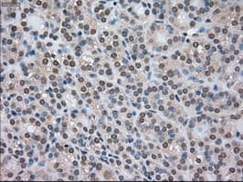 CTAG1B / NY-ESO-1 Antibody (clone OTI3C9)