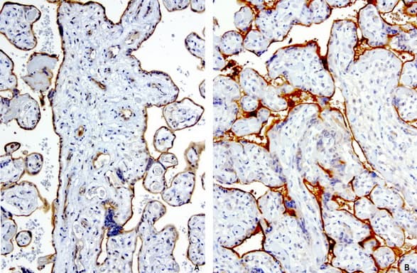 PROCR / EPCR Antibody (aa1-210, clone UMAB200)