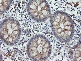 CATIP / C2orf62 Antibody (clone OTI4B4)