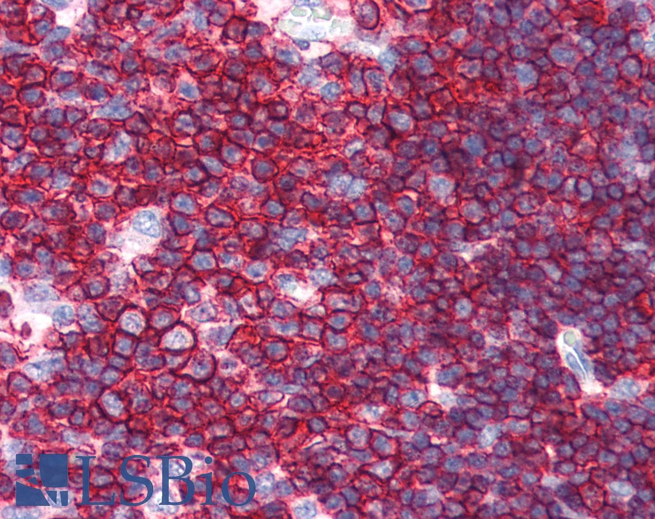 IHC-plus™ SPN / CD43 Antibody (clone MEM-59)