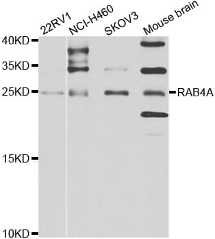 IHC-plus™ RAB4A / RAB4 Antibody