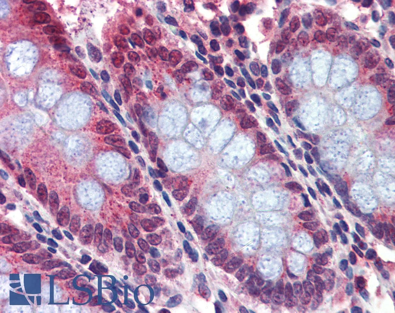 IHC-plus™ BACE2 Antibody