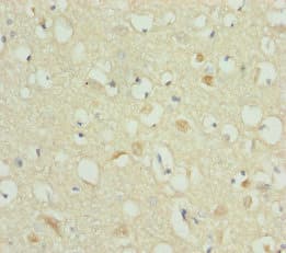 Polyclonal Rabbit anti-Human RBFOX1 / A2BP1 Antibody (IHC)