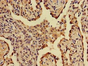 A2ML1 Antibody