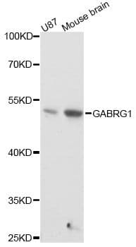 Polyclonal Rabbit anti-Human GABRG1 Antibody (WB)