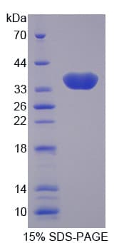Human CA8 / Carbonic Anhydrase VIII Protein (Recombinant His)