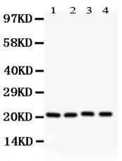 Polyclonal Rabbit anti-Human CAV1 / Caveolin 1 Antibody (aa4-178, IHC, WB)