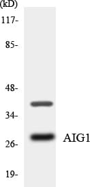 AIG1 Antibody (aa187-236)