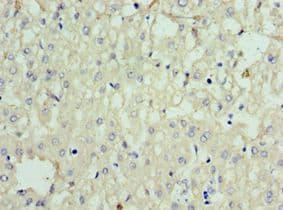 Polyclonal Rabbit anti-Human SOST / Sclerostin Antibody (aa24-213, IHC)
