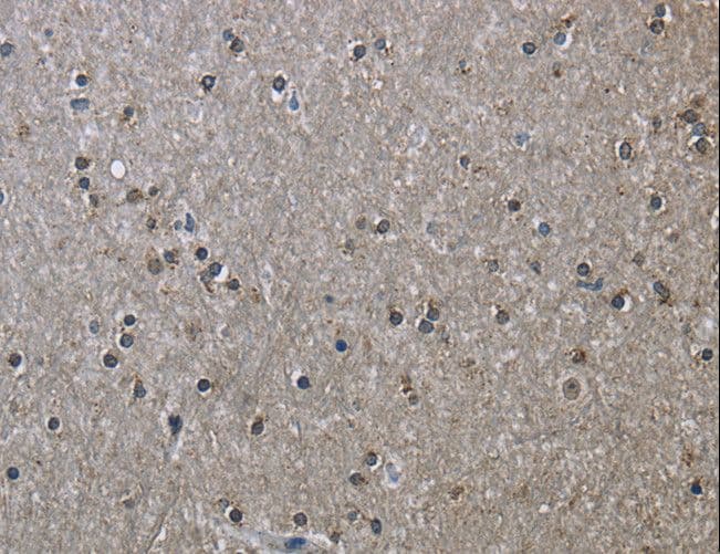 HSPA9 / Mortalin / GRP75 Antibody