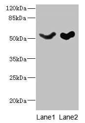 IHC-plus™ SLC25A25 Antibody