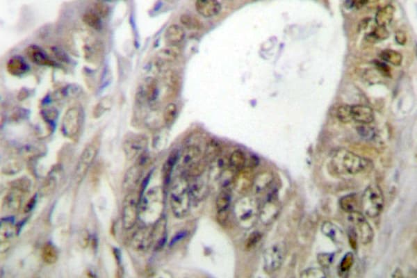 Polyclonal Rabbit anti-Human TCF7 Antibody (Phe26, IHC, WB)