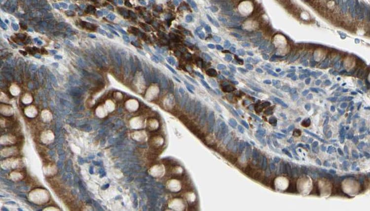 Polyclonal Rabbit anti-Human GIPR / GIP Receptor Antibody (IHC, IF, WB)