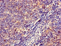 HLA-DQB1 Antibody