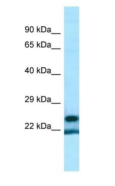 Polyclonal Rabbit anti-Human YRDC Antibody (aa136-185, IHC, WB)