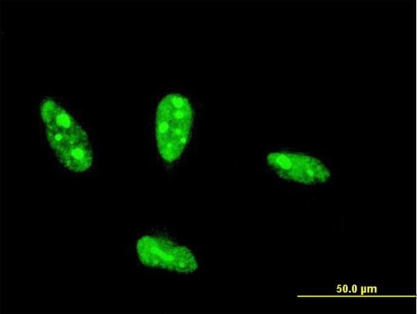 Monoclonal Mouse anti-Human NHLH2 / HEN2 Antibody (clone 4E4, IF, WB)