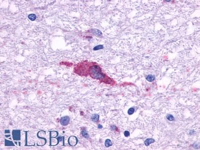 PathPlus™ HTR1F / 5-HT1F Receptor Antibody (Cytoplasmic Domain)