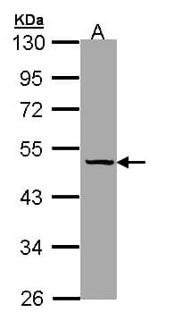 SERPINA7 / TBG Antibody (aa1-371)