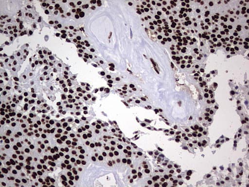 HNRNPL / hnRNP L Antibody (aa270-502, clone OTI9F11, Carrier-free)