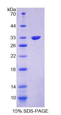 Mouse PPP1R15A / GADD34 Protein (Recombinant His-T7)