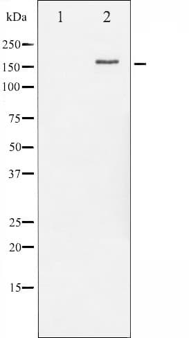 ERBB2 / HER2 Antibody (phospho-Tyr877)