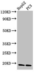 CAV2 / Caveolin 2 Antibody