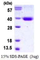 Human STX11 / Syntaxin 11 Protein (Recombinant His)