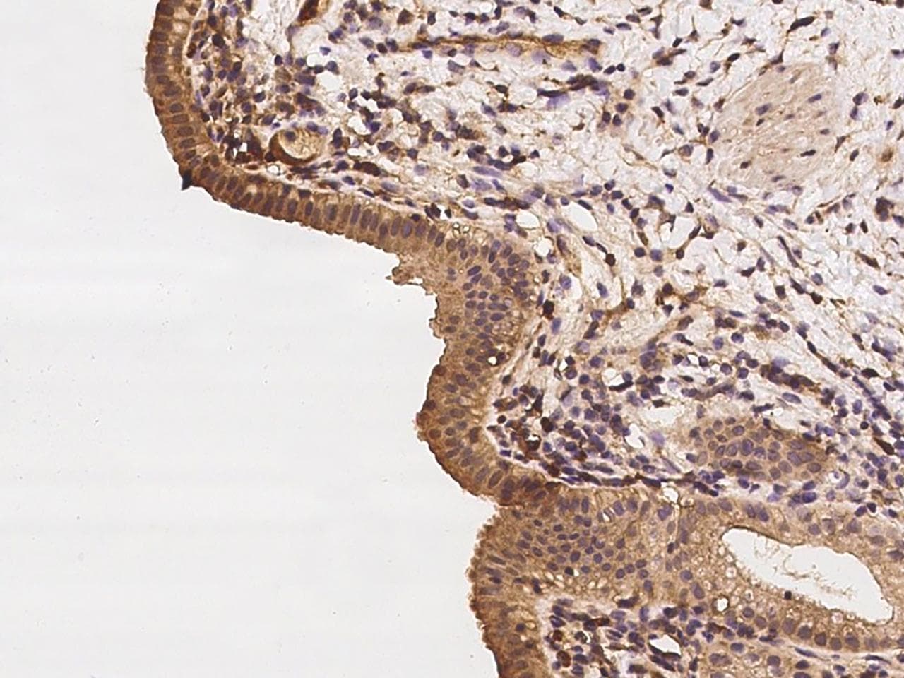 CALCOCO2 Antibody
