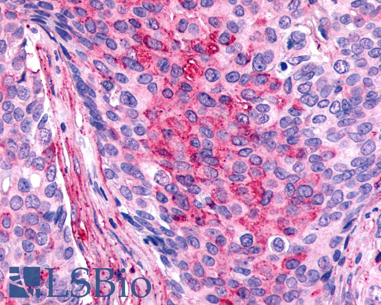 IHC-plus™ FZD7 / Frizzled 7 Antibody (N-Terminus)