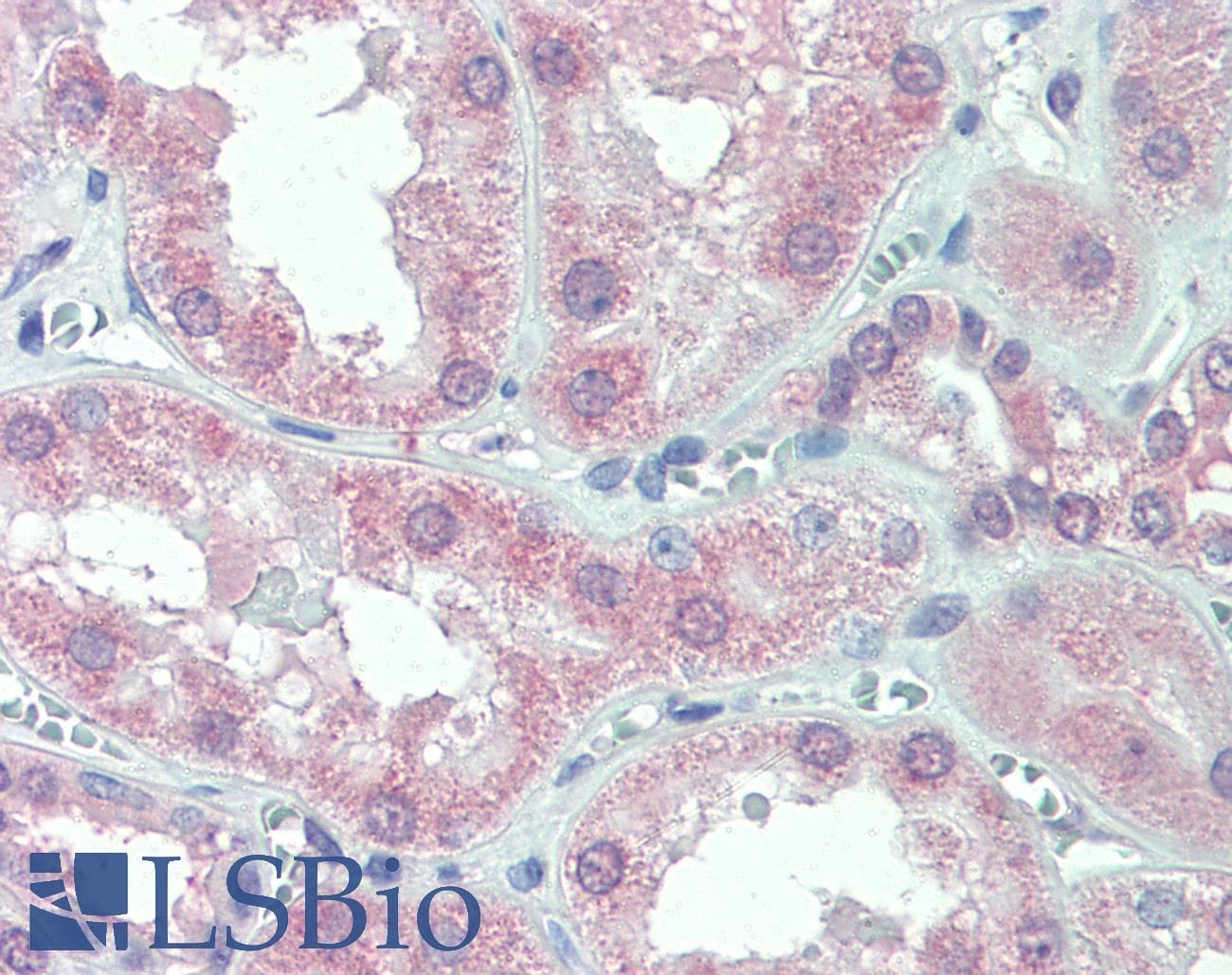 IHC-plus™ SLC11A2 / DMT1 Antibody (C-Terminus)