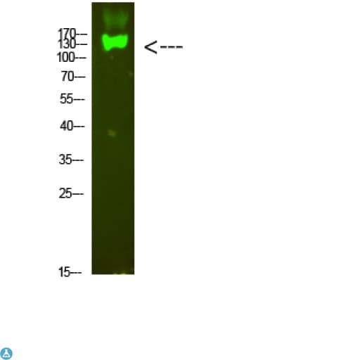 Polyclonal Rabbit anti-Human ITGB7 / Integrin Beta 7 Antibody (WB)