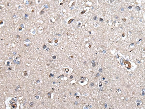 UMPS / OPRT Antibody