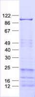 Human ZBTB24 / BIF1 Protein (Recombinant His, N-Terminal)