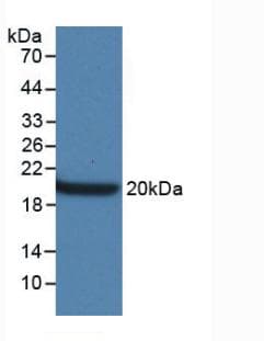 AQP4 / Aquaporin 4 Antibody