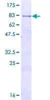 Human LYN Protein (Recombinant GST)