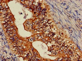 Polyclonal Rabbit anti-Human ASTN2 Antibody (IHC, IF, WB)
