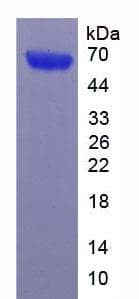 Human WNT5A Protein (Recombinant 6His, N-terminus)