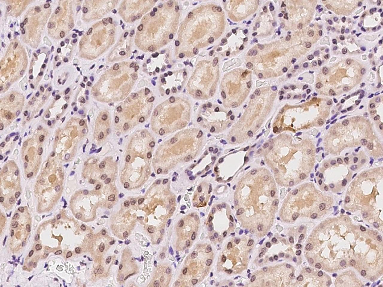 Polyclonal Rabbit anti-Human NR4A2 / NURR1 Antibody (IHC, IF)