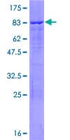 Human DDX47 Protein (Recombinant GST)