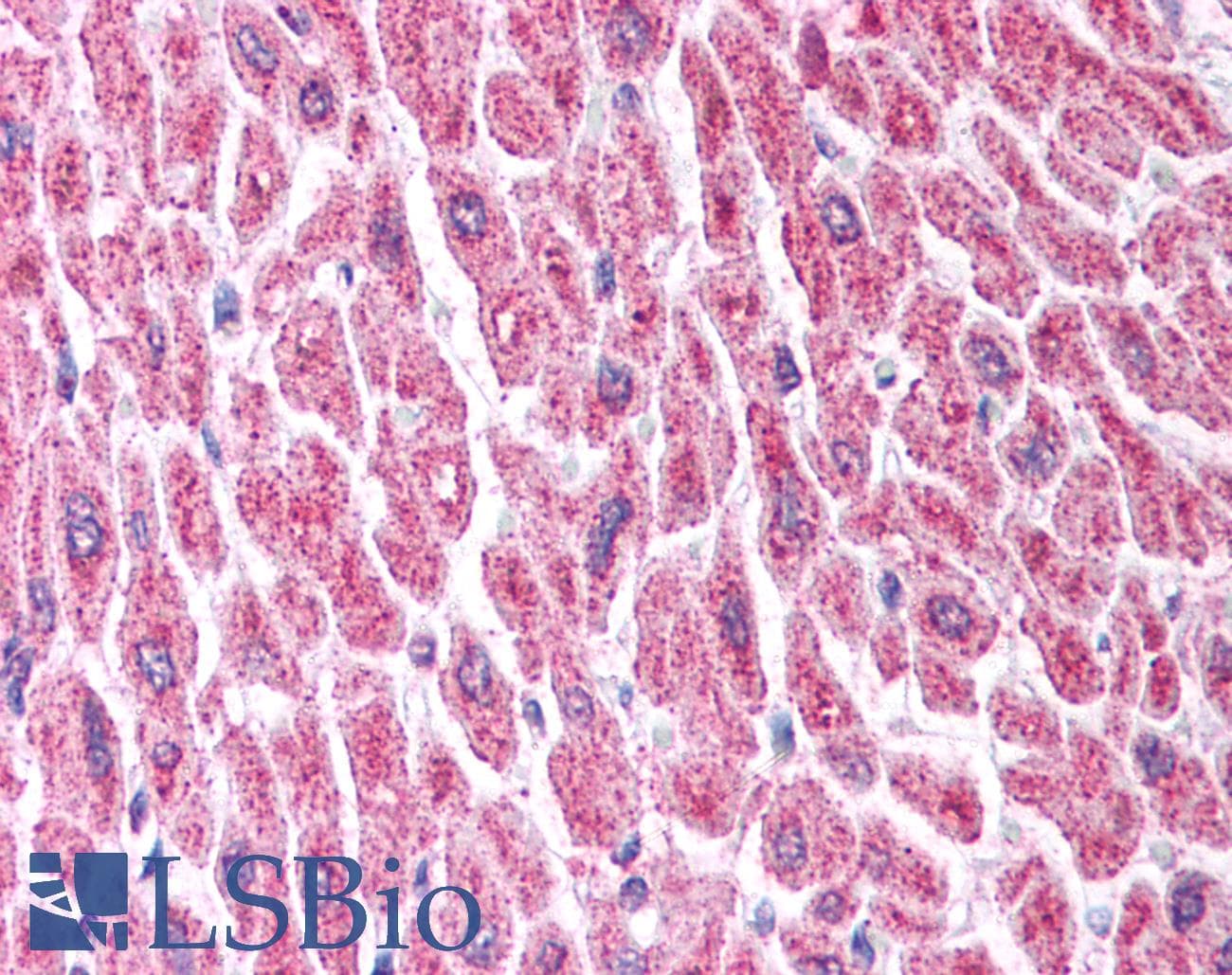 Polyclonal Rabbit anti-Human HDAC8 Antibody (C-Terminus, IHC, WB)