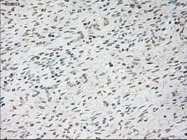 TNNI3 / Cardiac Troponin I Antibody (clone OTI4A3)