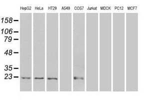 AK1 / Adenylate Kinase 1 Antibody (clone OTI8A1)
