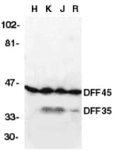 IHC-plus™ DFFA / ICAD / DFF45 Antibody
