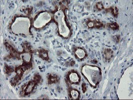 PADI4 / PAD4 Antibody (clone OTI5E7)