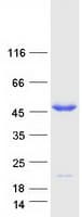 Human PPM1B Protein (Recombinant Myc-DDK (Flag))